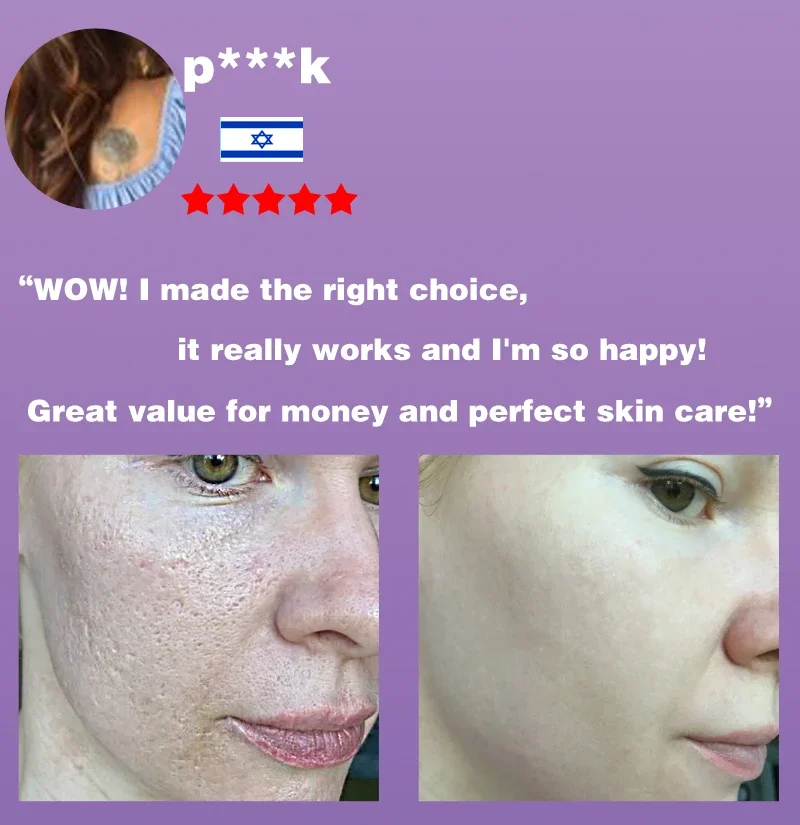 Removing Large Pores Pore Shrinking Serum Face Tightening Repairing Facial Pore Minimizing Moisturizing Skin Care Beauty Improve