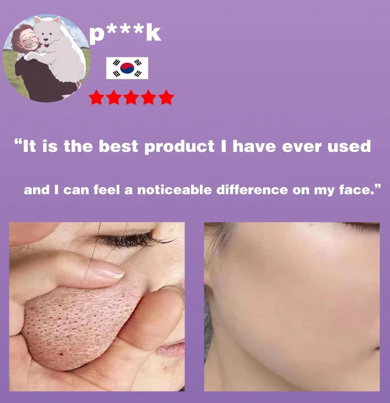 Removing Large Pores Pore Shrinking Serum Face Tightening Repairing Facial Pore Minimizing Moisturizing Skin Care Beauty Improve