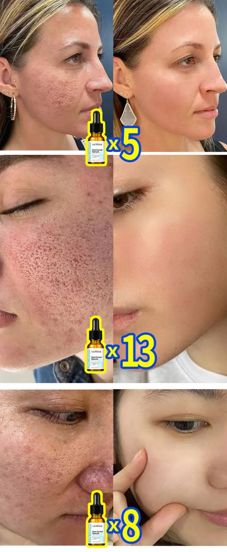 Removing Large Pores Pore Shrinking Serum Face Tightening Repairing Facial Pore Minimizing Moisturizing Skin Care Beauty Improve