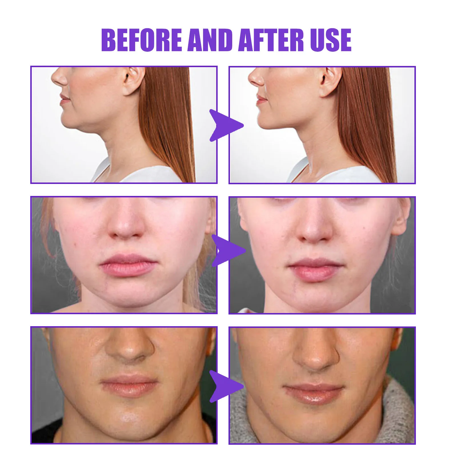 V Shape Slimming Cream Firming Face-lift Remove Masseter Muscle Double Chin Tighten Mandibular Fat Burning Cream Fade Neck Lines