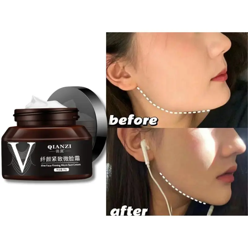 V Shape Slimming Cream Firming Face-lift Remove Masseter Muscle Double Chin Tighten Mandibular Fat Burning Cream Fade Neck Lines